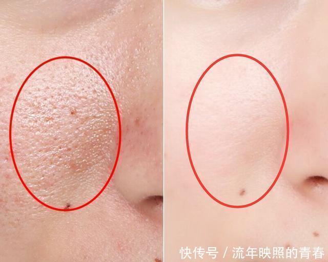  「道破」护肤时，“精华液”为啥不能直接擦脸上“北大医生”道破真相