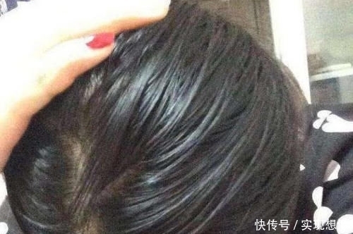 【源于】冬天头皮屑过多,是源于这4种坏习惯,若能改善头发清爽又干净