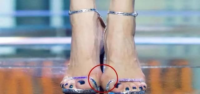 穿高跟鞋有多辛苦？宋茜脚变形，徐璐的脚都快垂直地面了