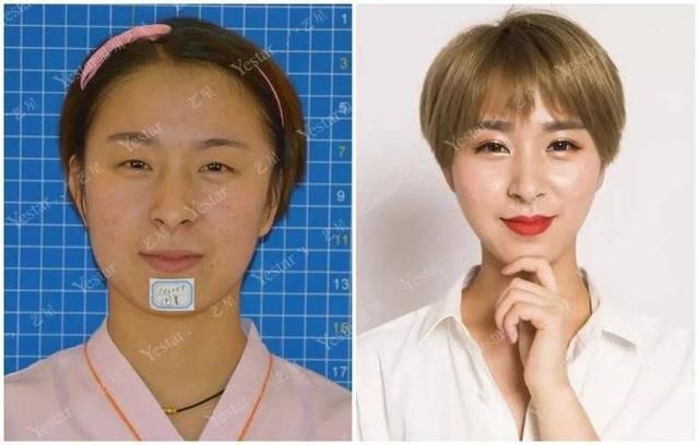  济南@想做双眼皮？先了解这8大误区！济南艺星第五季美杜莎女郎征集中