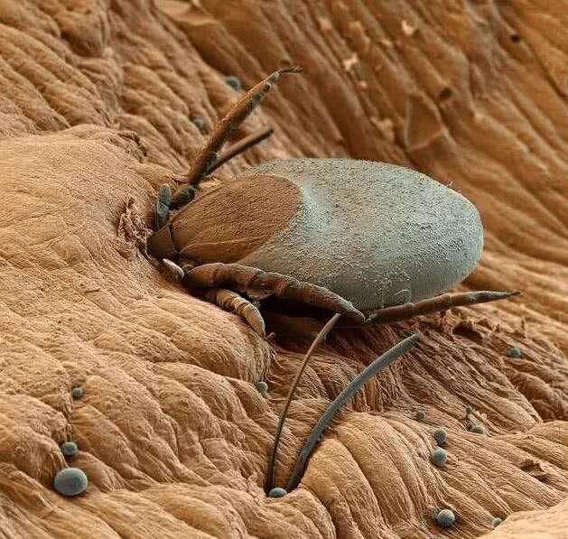 上万螨虫天天在脸上打洞，会有4感觉，坚持3方法彻底跟螨虫说再见