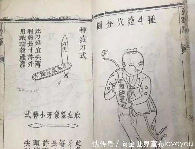  世界卫生组织@曾造成数亿人死亡的“天花”，为什么能被彻底消灭掉！