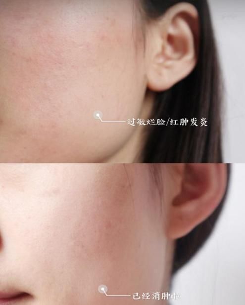 张馨予也在使用的面霜火了，好用程度堪比换皮，香奈儿都比不上它