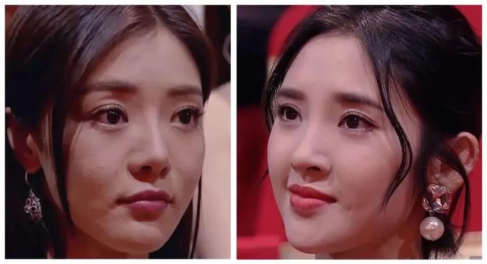 整容遭报应?她的少女脸这么快就烂了?