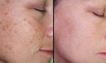 女性朋友常用两种“天然乳膏，皮肤祛斑有弹性，满脸胶原蛋白