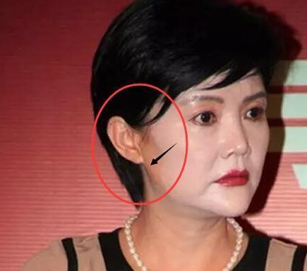 皮肤科专家不经意说出:女人老不老，看这几个地方就一清二楚，牛