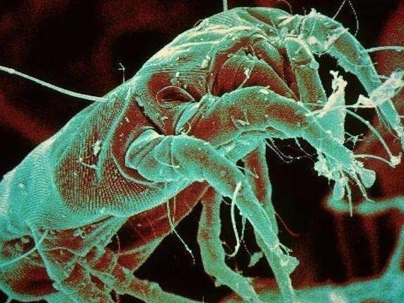 鼻子黑头多, 是螨虫排泄物太多, 除螨2招收入囊中, 黑头不再长