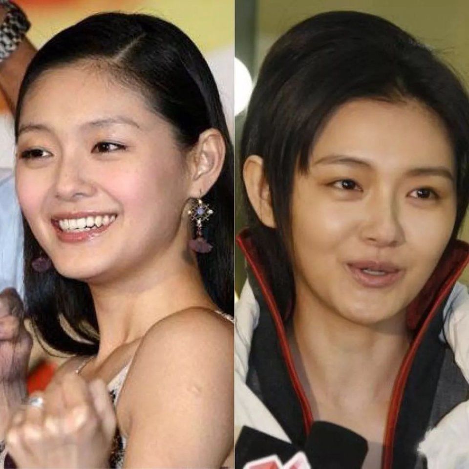 曝大S童年"黑"历史,拼命美白会有害健康么?