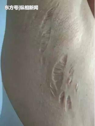 女方■罗生门?女医师发文称遭前夫“药物投毒”!男方回应:女方诬告
