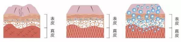 李湘瘦了之后美回来了!42岁活出22岁的少女感