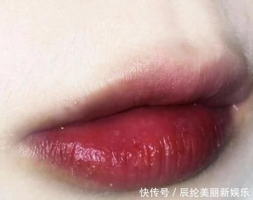 「戒掉」学生党想要“樱桃小嘴”?一定戒掉3个习惯,不然迟早变香肠嘴