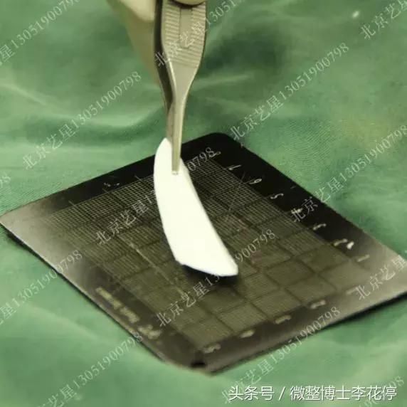 实锤：国民闺女，整容了？