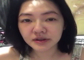 转发杨超越就能心想事成?别迷信了先瘦瘦脸吧