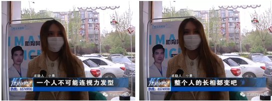  『院方提供』整形去艾美 鼻子穿孔了？