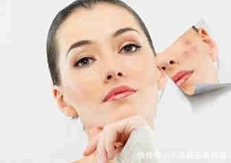 快速:快速消除红痘印的方法