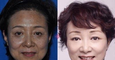  「恢复」学会用生姜加“它”敷脸，淡斑除皱两不误，15天恢复白嫩光洁肌