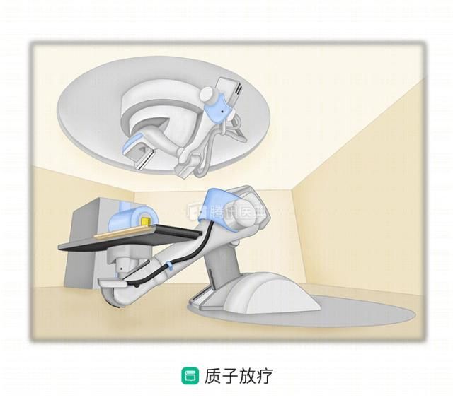  『放疗技术』医治直肠癌，这5大“新武器装备”你一定要了解，能精确杀掉肿瘤干细胞，快看一下