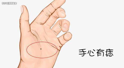 不论男女，手上没有这个东西，恭喜你癌细胞离你还很远