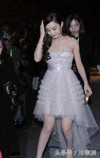 赵丽颖为何穿裙子“从来不穿丝袜”, 其实不是不想穿，而是不能穿