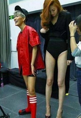 女孩拥有一双大长腿，却不能像平常女孩一样!