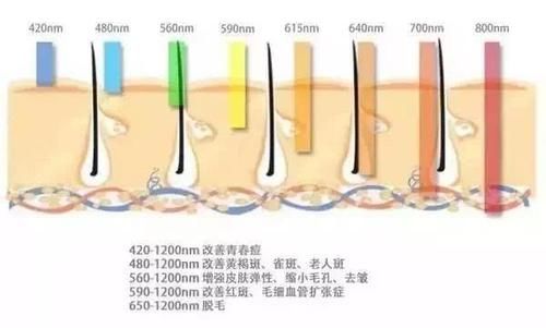  『皮肤』光子嫩肤\OPT值得尝试吗？为什么要在医院弄？