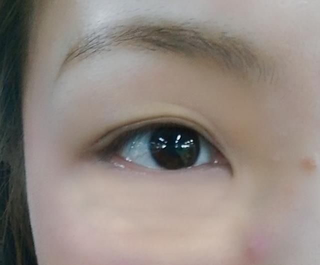 药店2块钱的VE+5个动作，7天消细纹+黑眼圈！