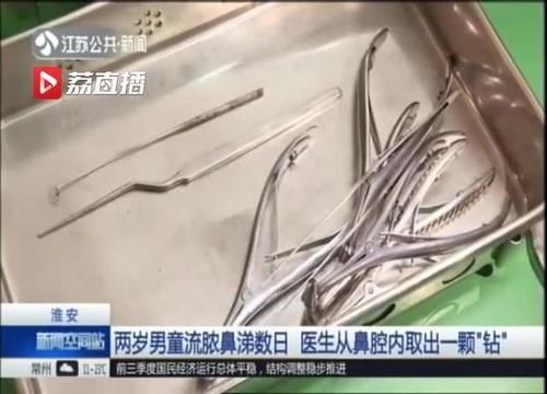 鼻腔@当心异物！淮安一两岁男童流脓鼻涕数日 医生从鼻腔内取出