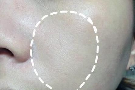 在药店这俩种水，分分钟美白淡斑，就是因为太便宜被很多人忽视!