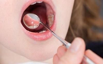 口服“美白丸”能防晒不靠谱?“科学”流言榜发布