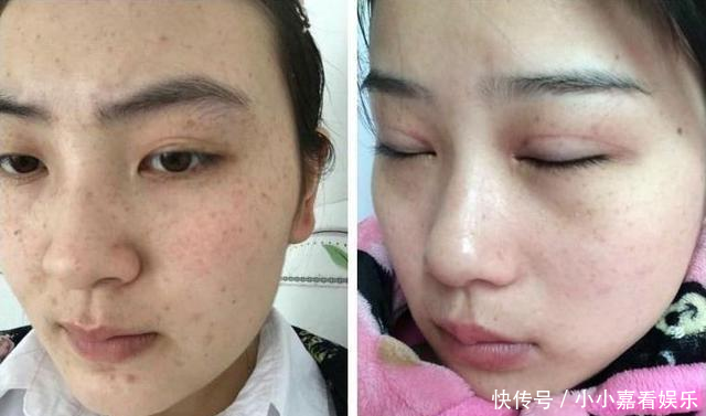  『脸部』牛奶加“它”涂抹脸部，一个月皮肤白嫩又光滑，色斑也变淡了不少