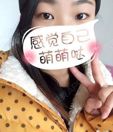  『眼睛』什么样的眼，能成就一张高级脸？|案例