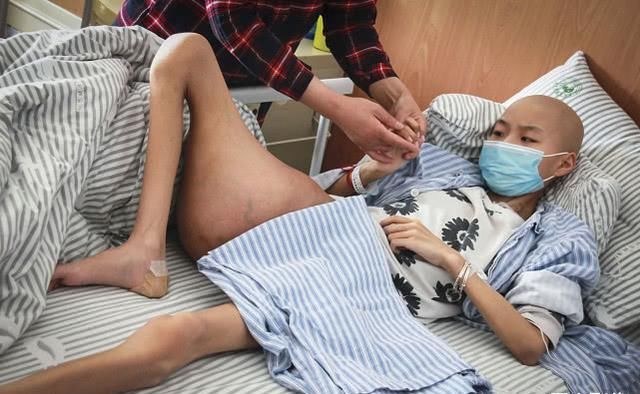 患癌■河南一家庭连续4人患癌去世, 今轮到11岁女孩, 为保命一条腿没了
