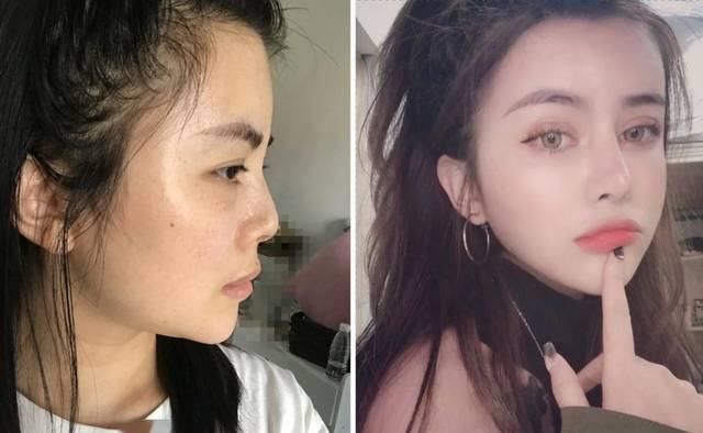  「看起来就」为什么做了整形也没有变好看