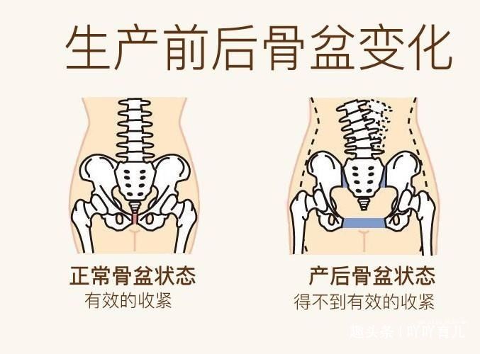 怀孕:生过宝宝的女性,身上会有4点痕迹,过来人一看便知