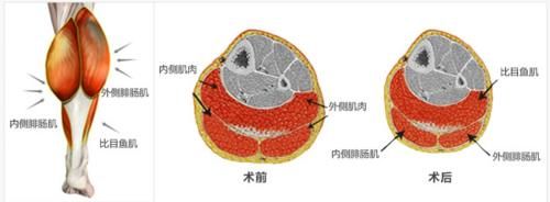  【试试】小腿难瘦？不如来试试女明星的美腿方法！
