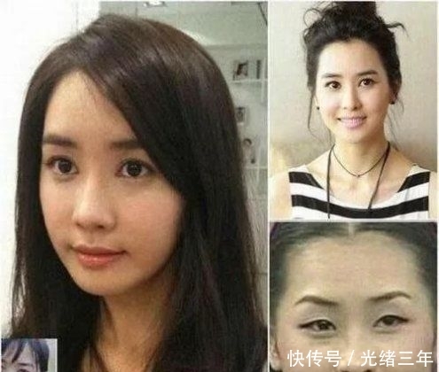 鼻子■鞠婧祎这是第几次do鼻子了?还没消肿就走红毯意外艳压全场!