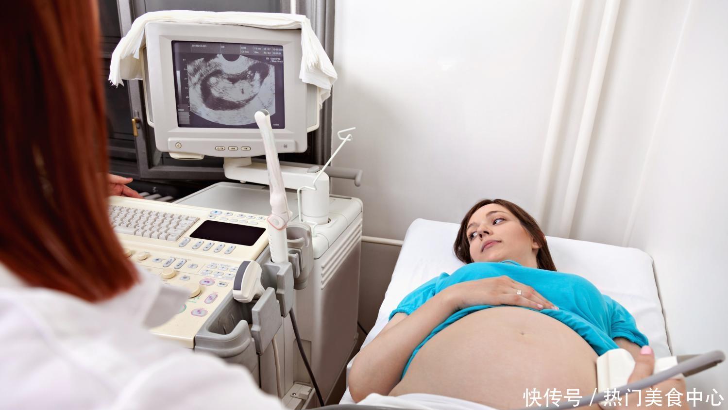 鸽子:孕妇吃鸽子对胎儿有什么好处呢 5个好处轻轻松松就收入“口袋”