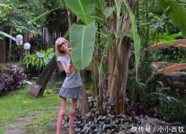 少女因害怕身体走形，每天坚持只喝水不吃食物，如今成“活骷髅”