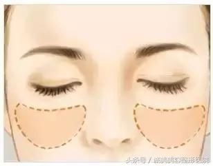 苹果肌和高颧骨之间有超大区别，你分得清楚吗？