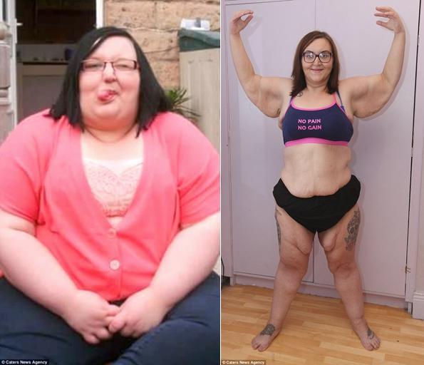 近400斤女子减去了一半体重，但还是开心不起来