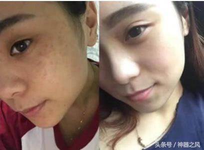 姥姥告诉我的1个方法,蜂蜜擦脸3年了,皮肤白皙水嫩斑也不见了