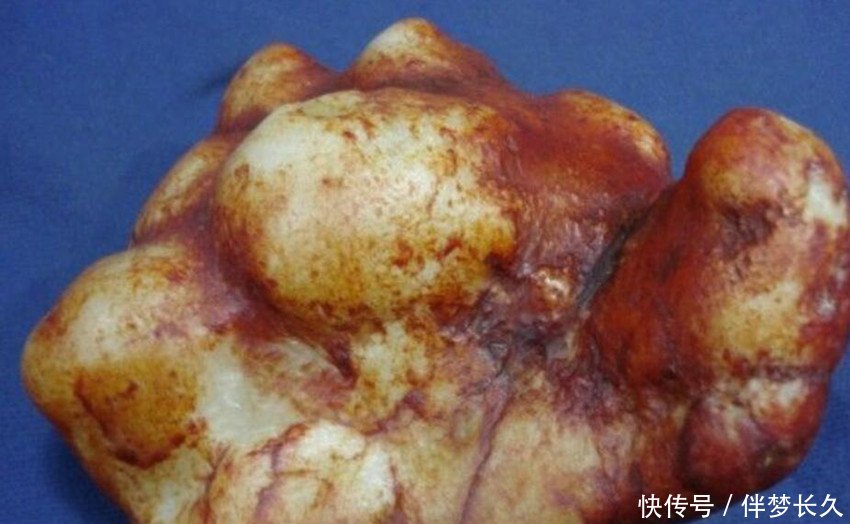 农民在田里挖到“土疙瘩”，专家鉴定后令他兴奋不已，捡到宝了