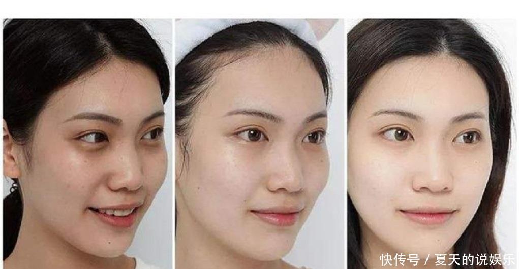  [脸上]“马齿苋”加它敷脸，美白祛斑有奇效，用过的人色斑早就没了！