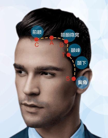 杭州小哥花4万做的发际线，火遍全网!深八这发际线到底挫在哪里