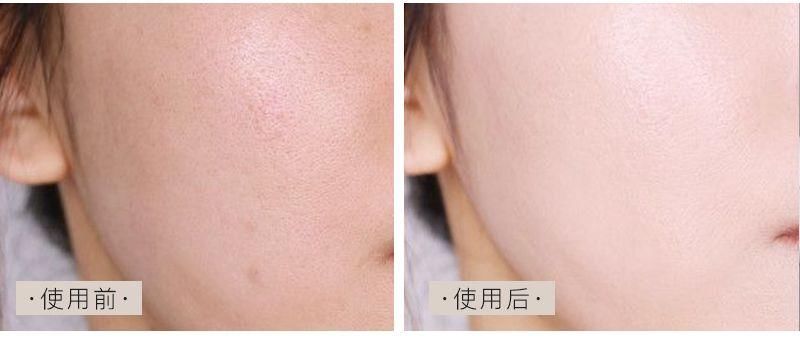 用它洗脸，面膜钱都省了，越洗越白净，洗完就能素颜出门