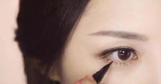 惊!戚薇开眼角了?还是无痛的