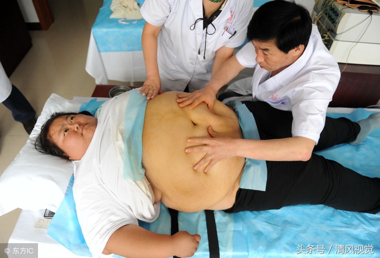 32岁姑娘体重356斤,会2门外语就业受歧视,按摩减肥欲找男友