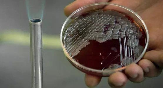 网传辽宁发生炭疽疫情，猪牛羊肉都不能吃!权威部门回应了...