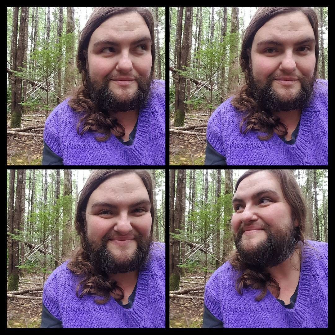 蓄起胡子留起了体毛，身患怪病的她让自己变得更有魅力了