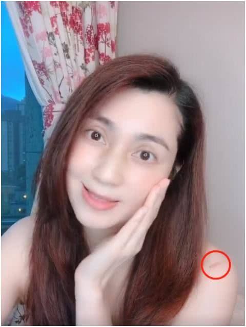 「泛红」49岁著名女星晒素颜照,露头皮疑似脱发,胳膊上泛红伤痕引担忧